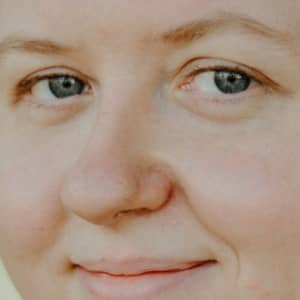 Rosacea Solutions