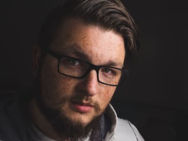 The Best Hyperpigmentation Treatments For Men