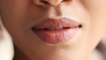 Why It’s Time To Trade Your Lip Filler For A Lip Lift