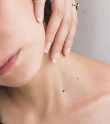 The Truth About ‘Mini’ Neck Lifts
