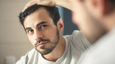 How To Reshape Your Hairline