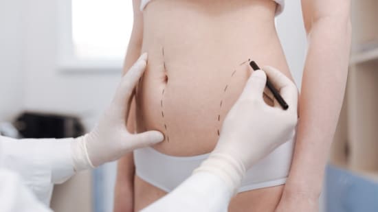 Why Everyone Is Talking About Fat Grafting