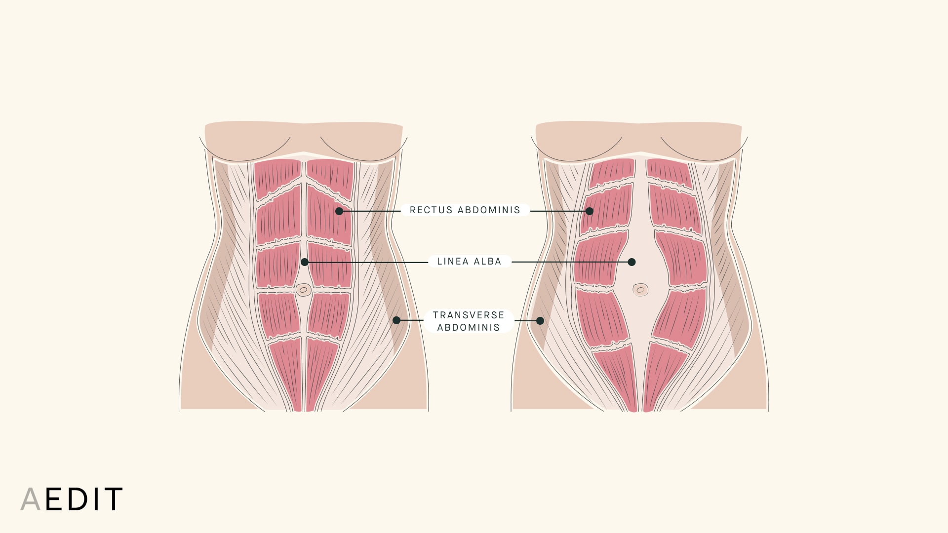 Abdominal Wall Anatomy Illustration