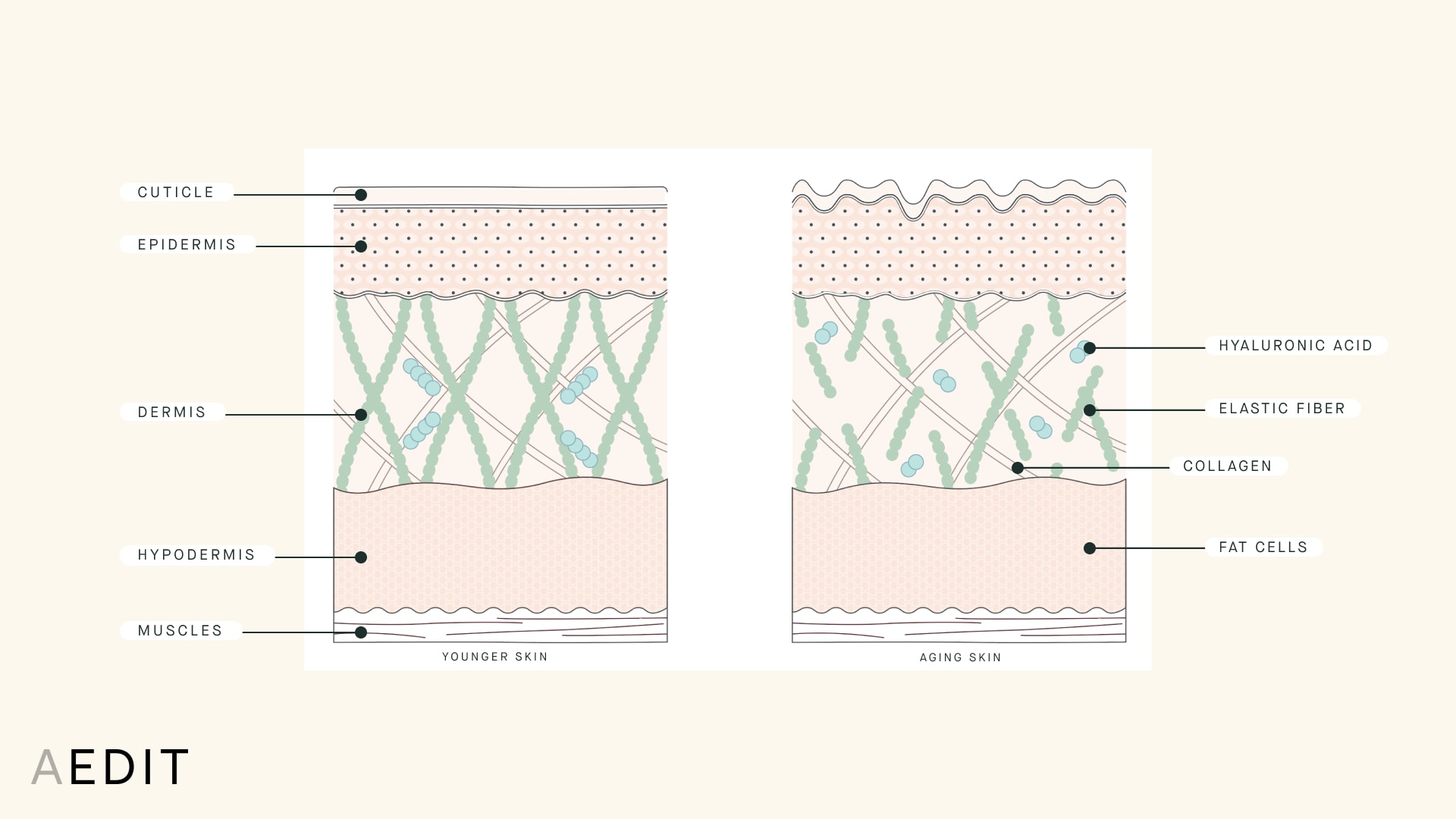 Aging Skin vs Younger Skin Cross Section Illustration