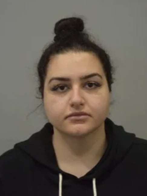 Buccal Fat Removal Before, Female 30 - 4740