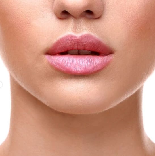 Lip Augmentation and Injections After, Female 27 - 1407