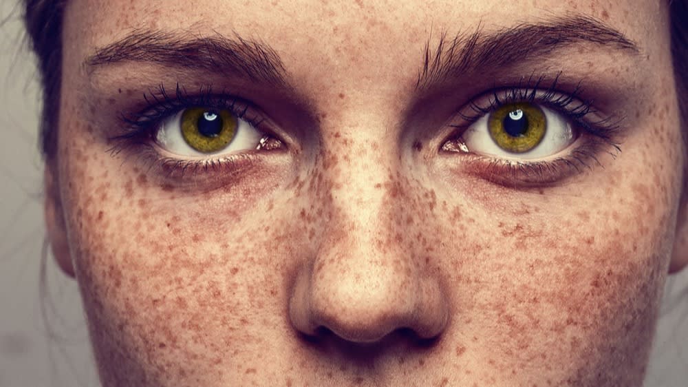 Reinventing Rhinoplasty: What's Different About Modern Nose Jobs