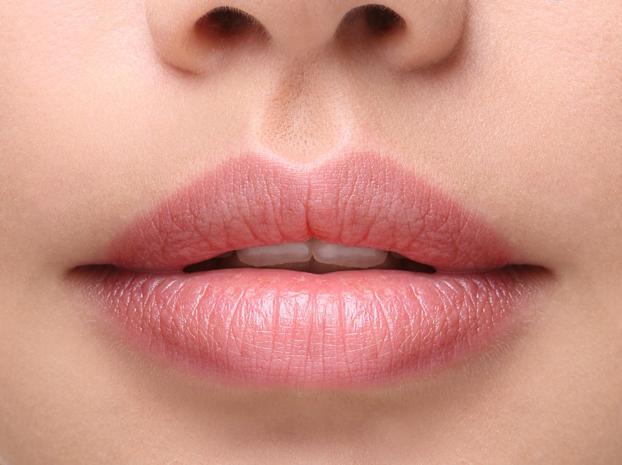 Why Cupid's Bow Procedures Are The Next Generation Of Lip Augmentation