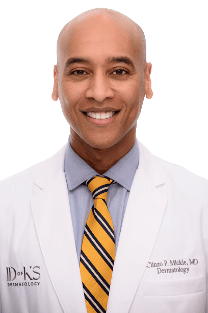 Clinzo Mickle