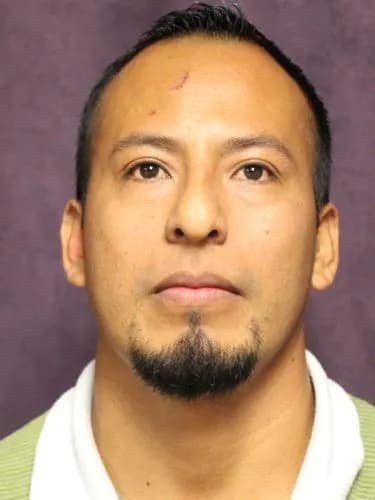 Rhinoplasty Before, Male 35 - 4511