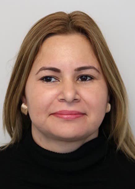 Submental Liposuction After, Female 51 - 2348