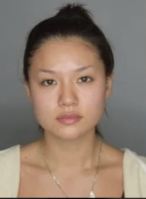 Buccal Fat Removal Before, Female 28 - 4735