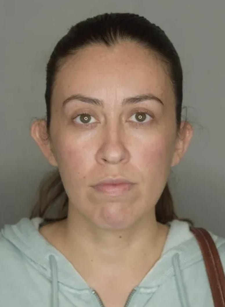 Otoplasty Before, Female 35 - 4746