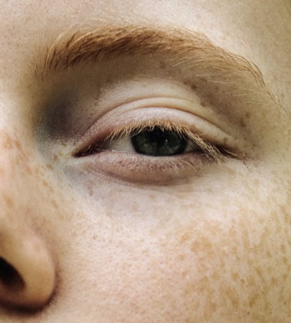 Eyelid Correction Solutions Overview - 1124