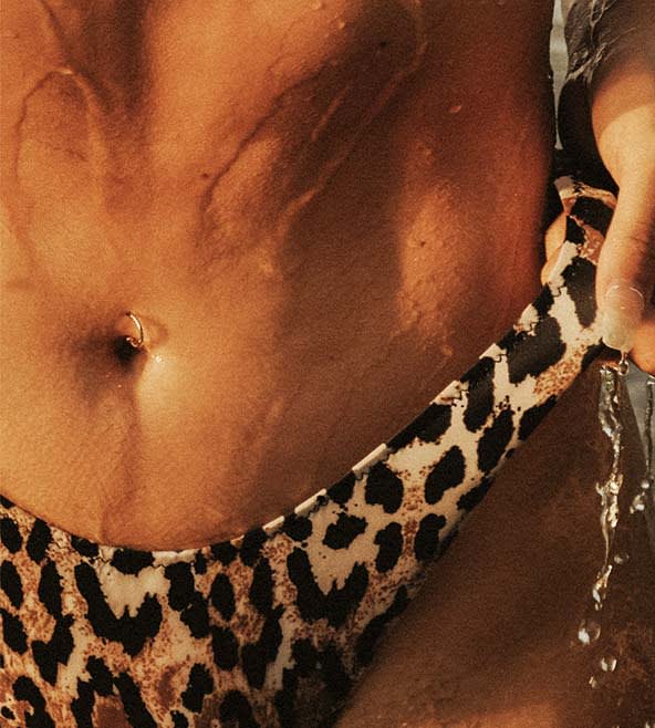 Vaginoplasty Overview - 788