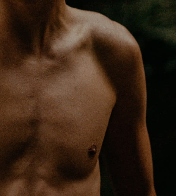 Male Breast Reduction Solutions Overview - 1131