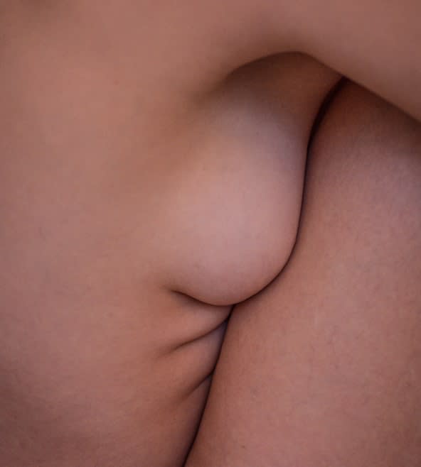 Liposuction Overview - 1021