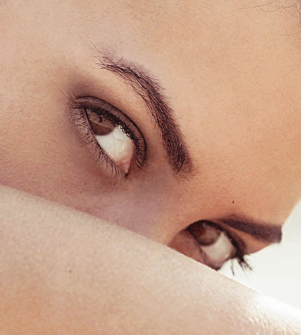 Direct Brow Lift Overview - 720