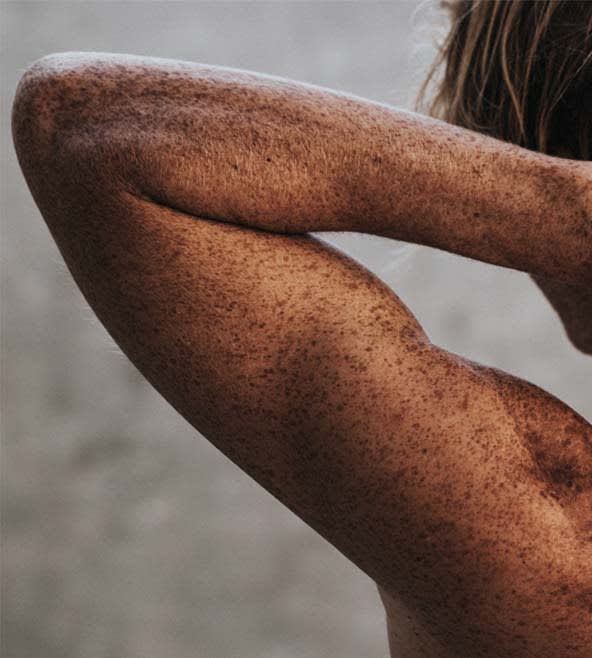 Arm Lift Overview - 787