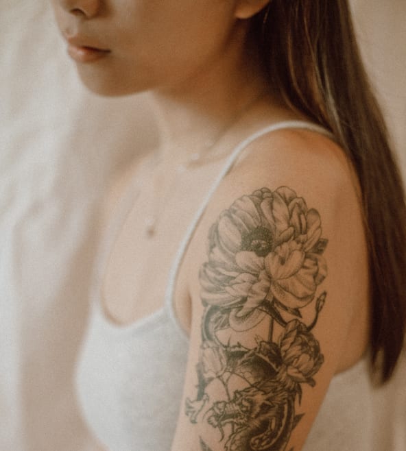 Tattoo Removal Solutions Overview - 1149