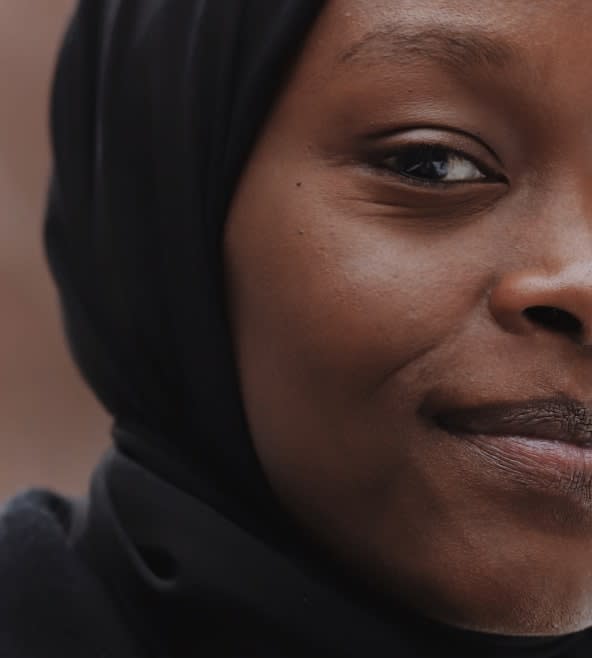 Microdermabrasion Overview - 776