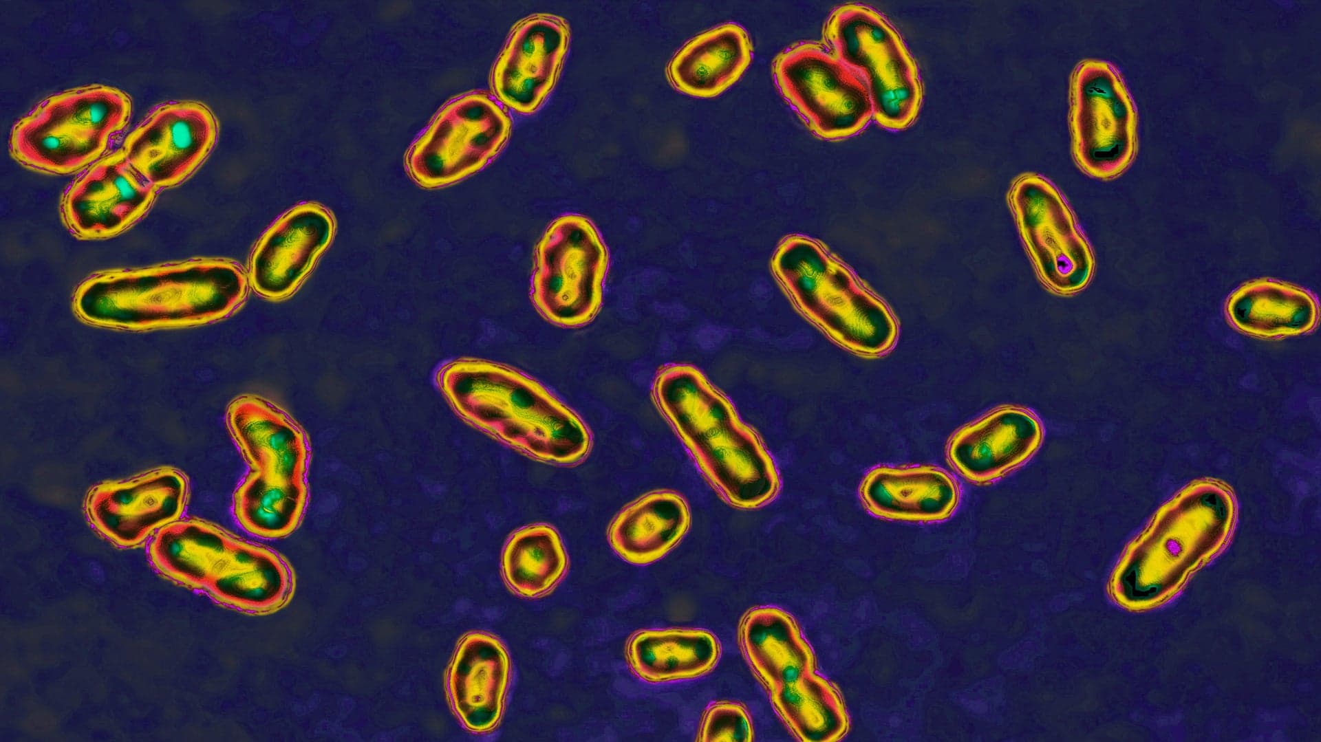 Yersinia pestis