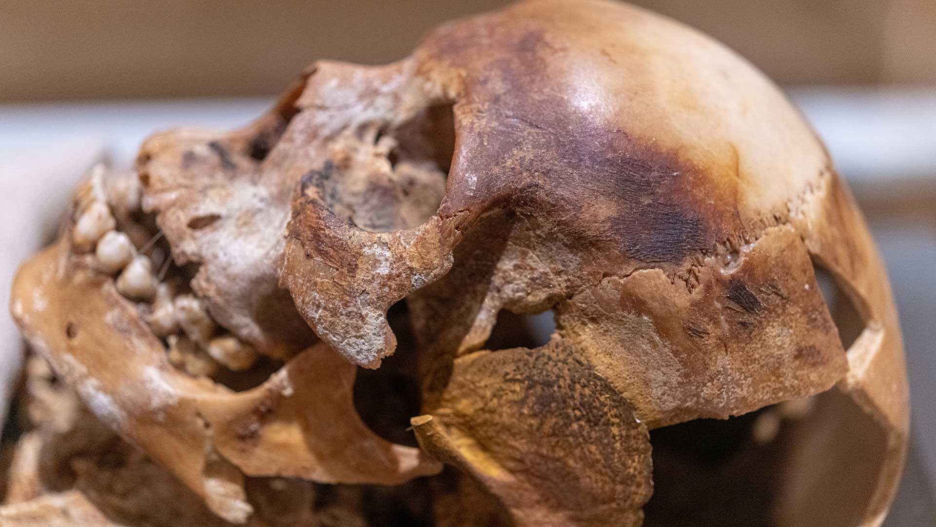 Skull of a man from ancient Egypt.