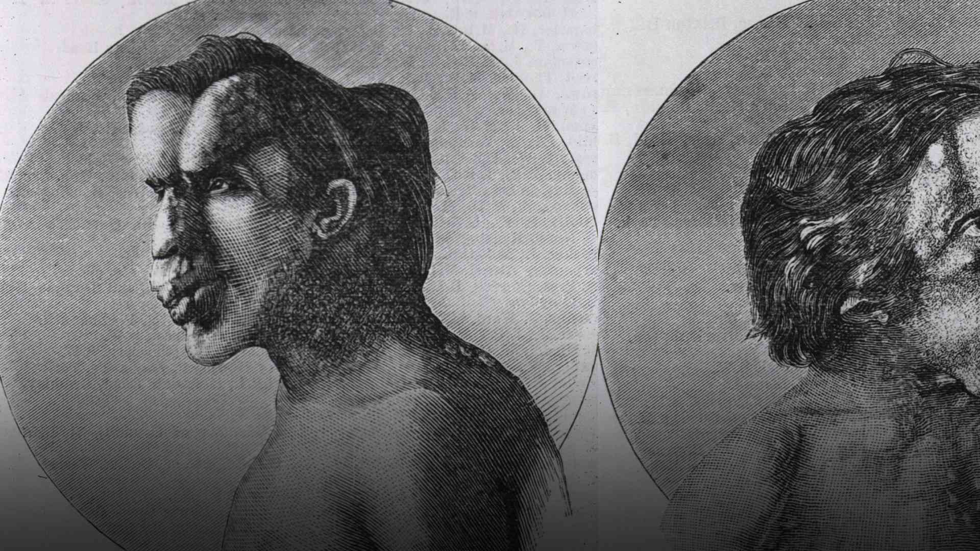 The Elephant Man