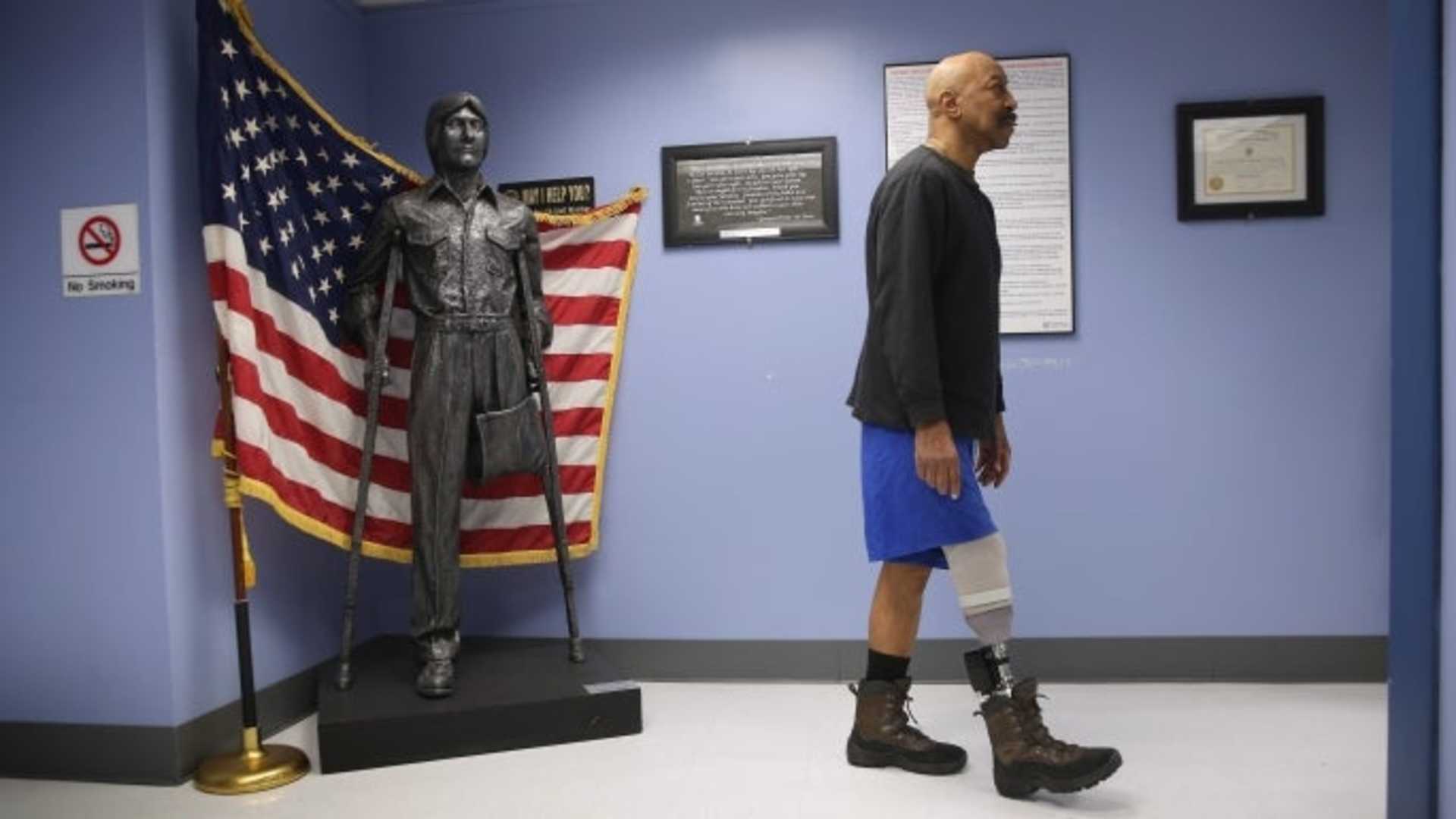U.S. Military veteran and amputee Lloyd Epps after doctors serviced his prosthetic leg at the Veterans Administration (VA), hospital in Manhattan, New York City, 2014. (Credit: John Moore/Getty Images)