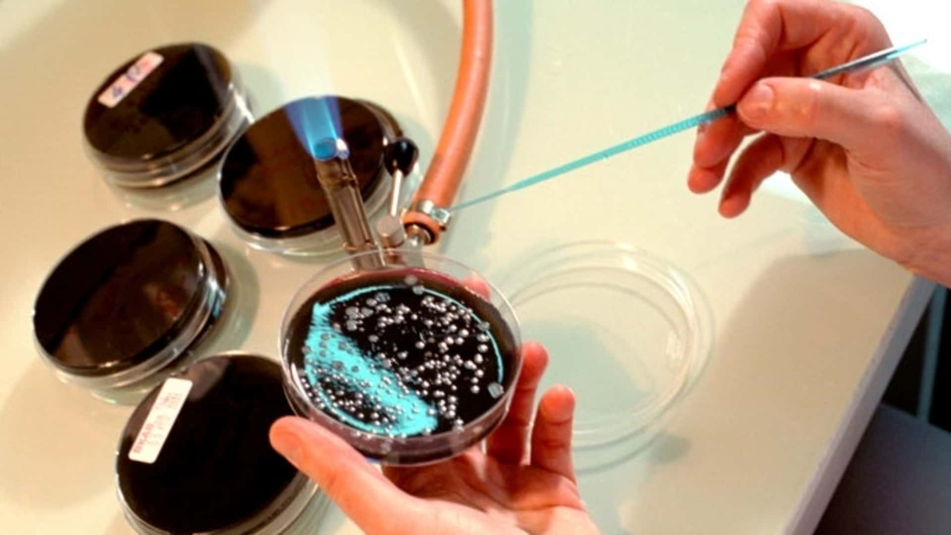 Legionella (Credit: BSIP/UIG/Getty Images)