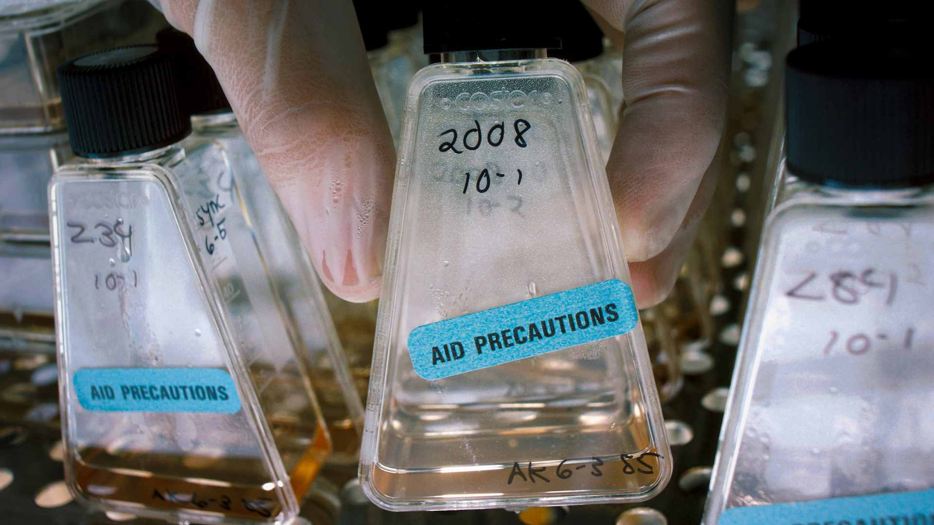 History of AIDS