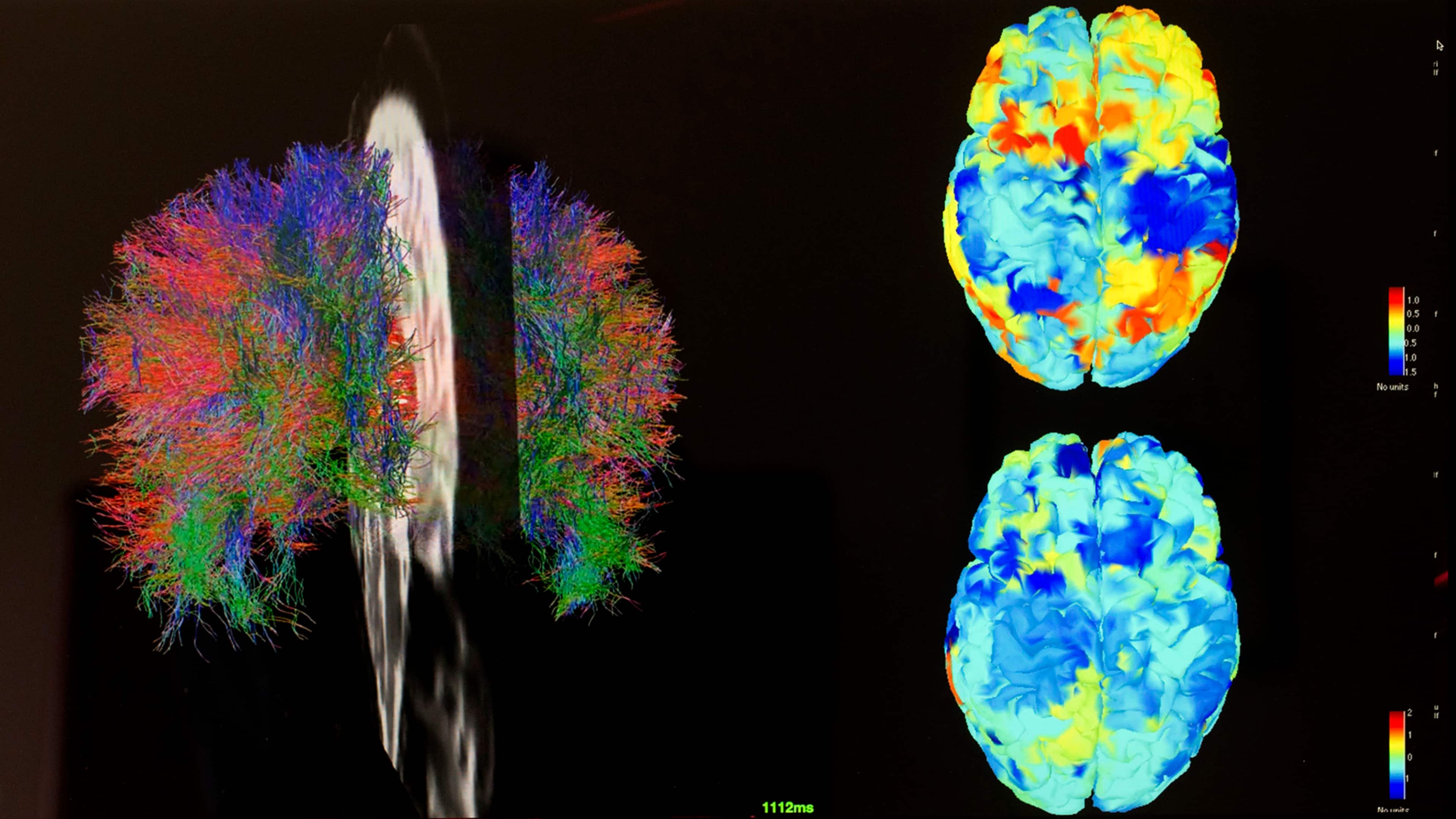 Neuroscientist Randy McIntosh