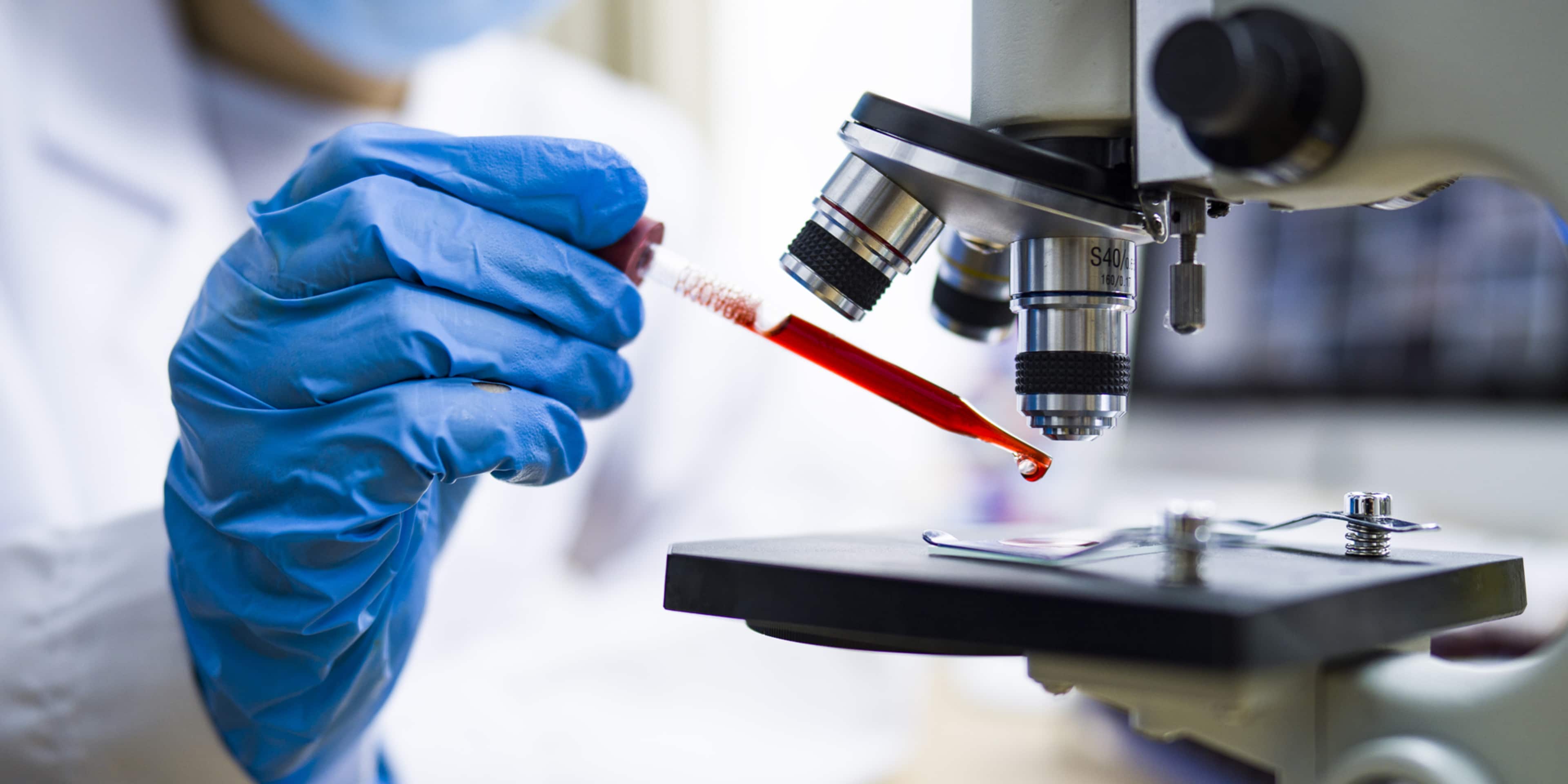 A person in blue gloves is using a microscope in a laboratory setting, with various scientific equipment visible in the background.