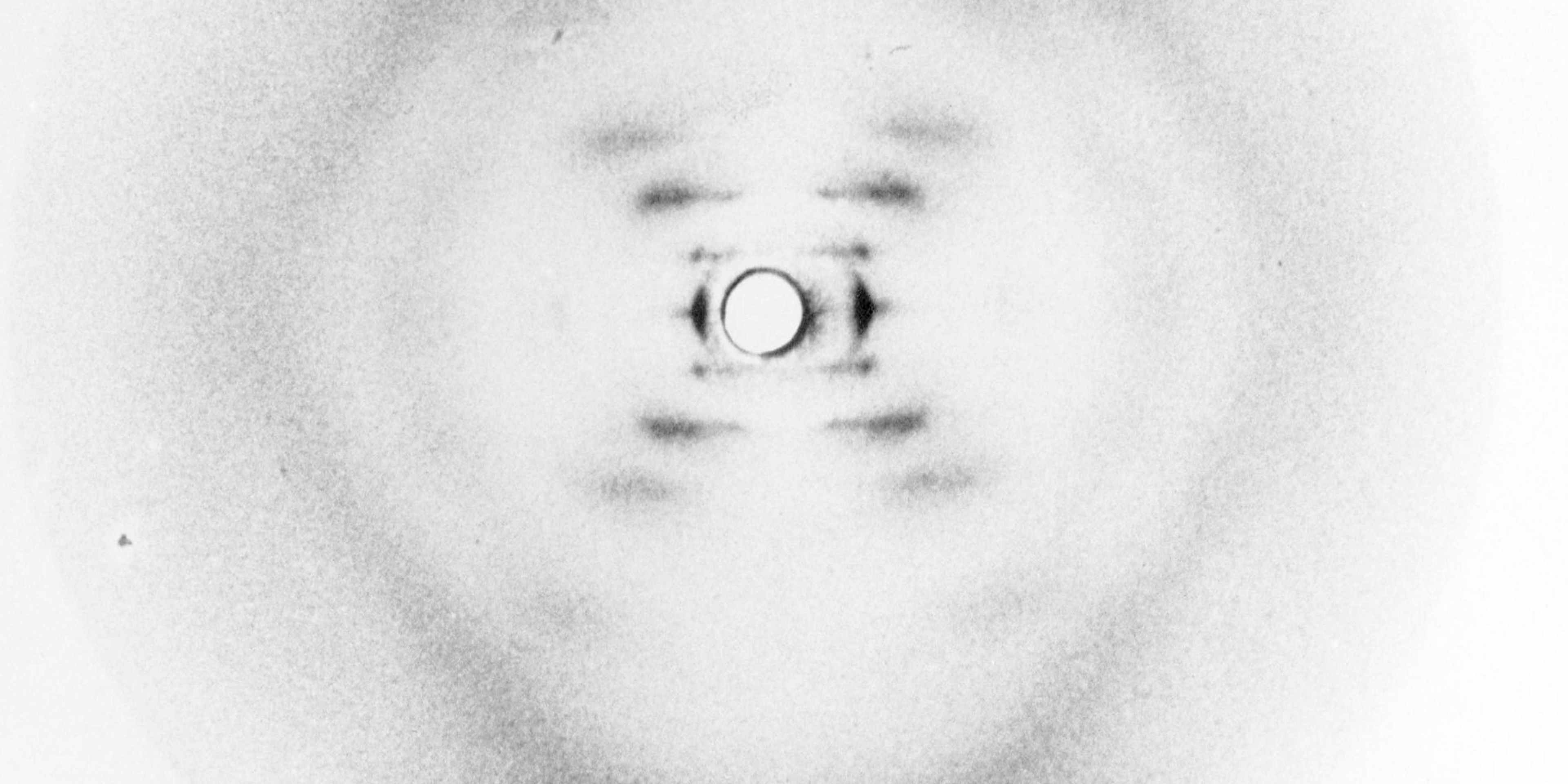 DNA discovery, X-ray diffraction, 1952