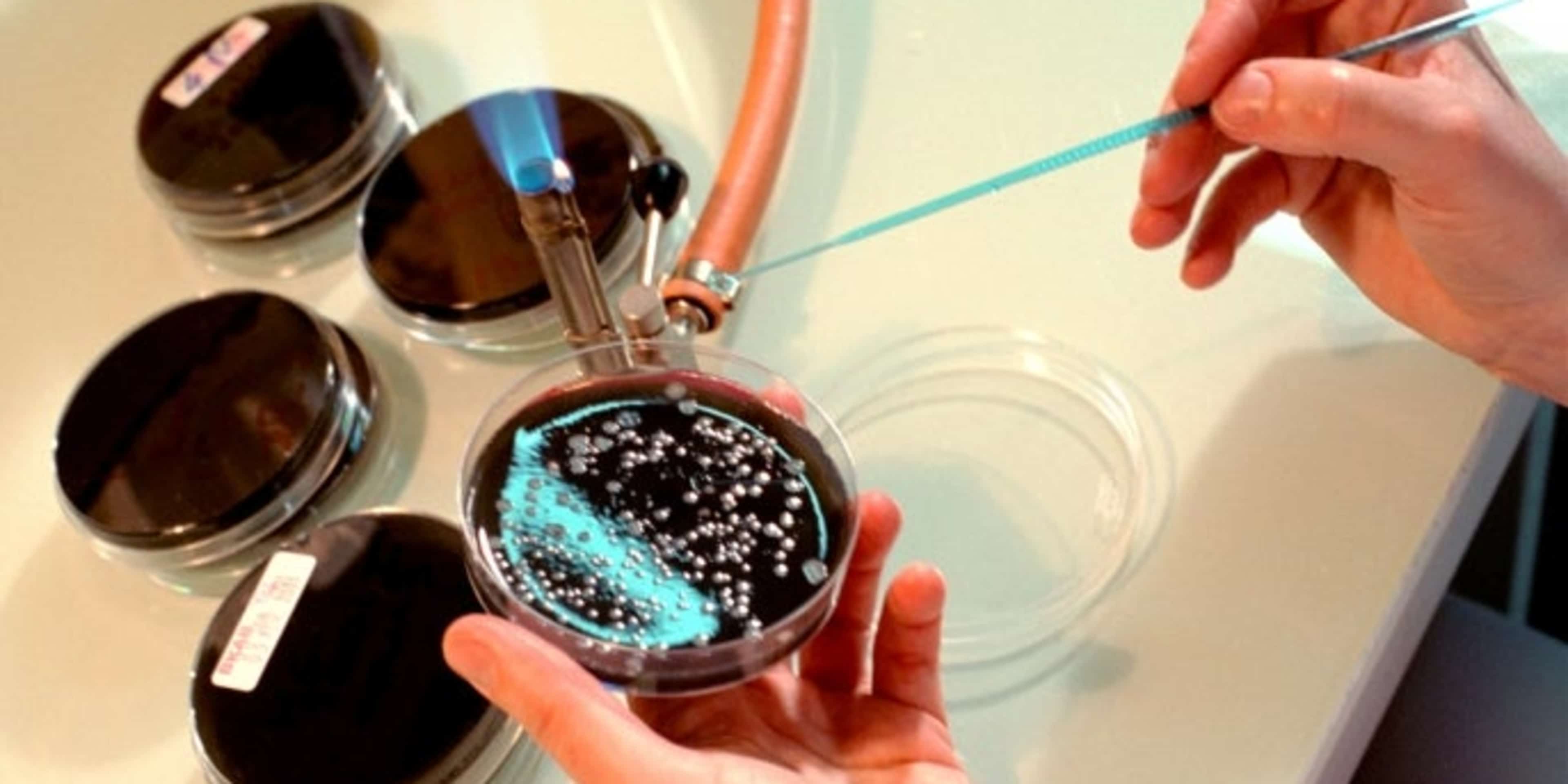 Legionella (Credit: BSIP/UIG/Getty Images)