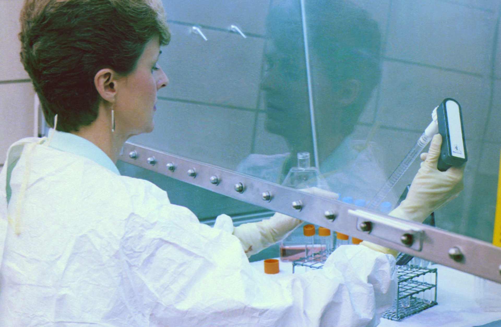 CDC AIDS research