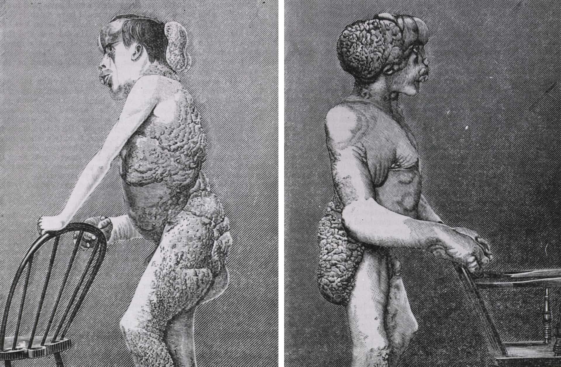 The Elephant Man