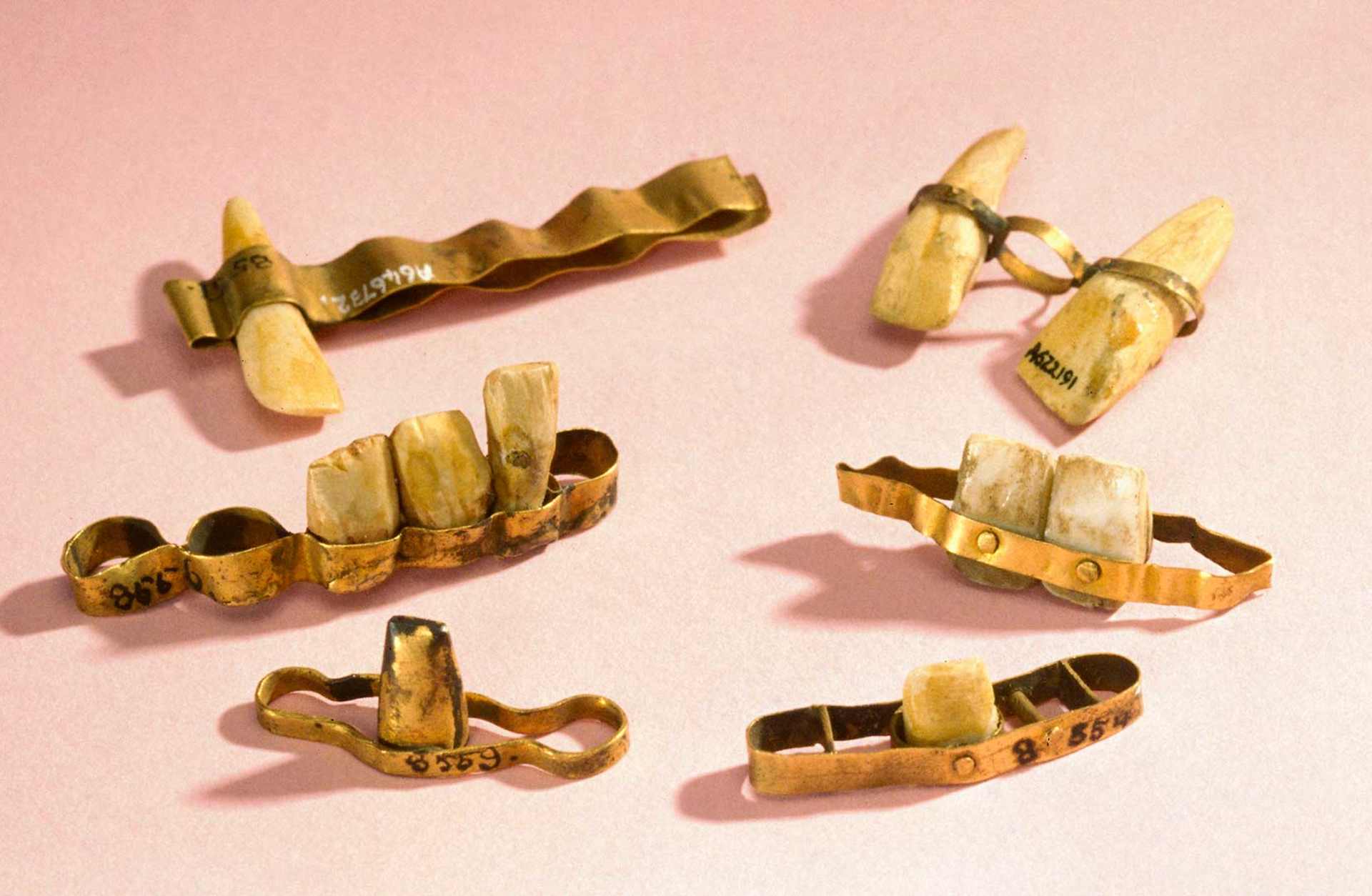 Examples of Etruscan dentures.