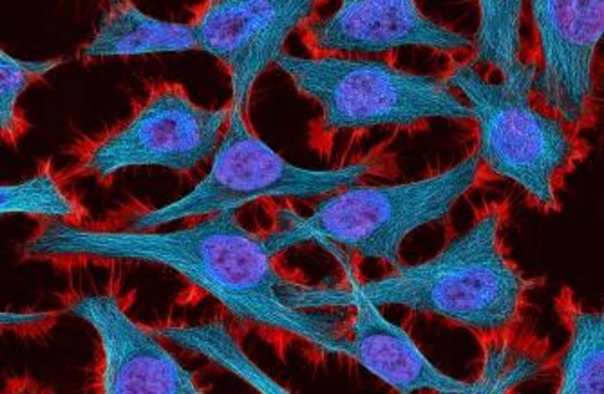 Multiphoton fluorescence image of stained HeLa cells. (Credit: Tom Deerinck/National Institutes of Health)