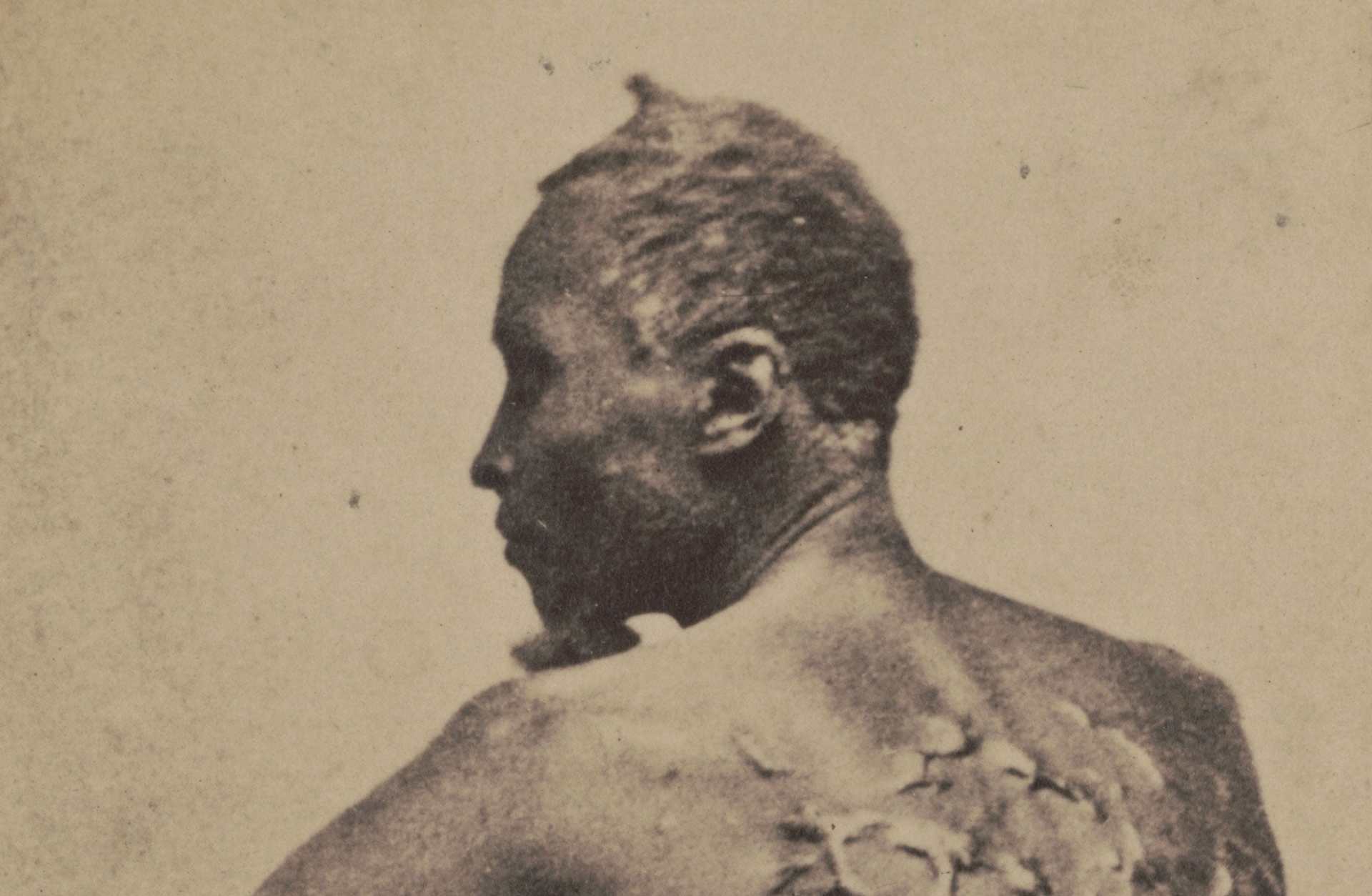 The Scourged Back