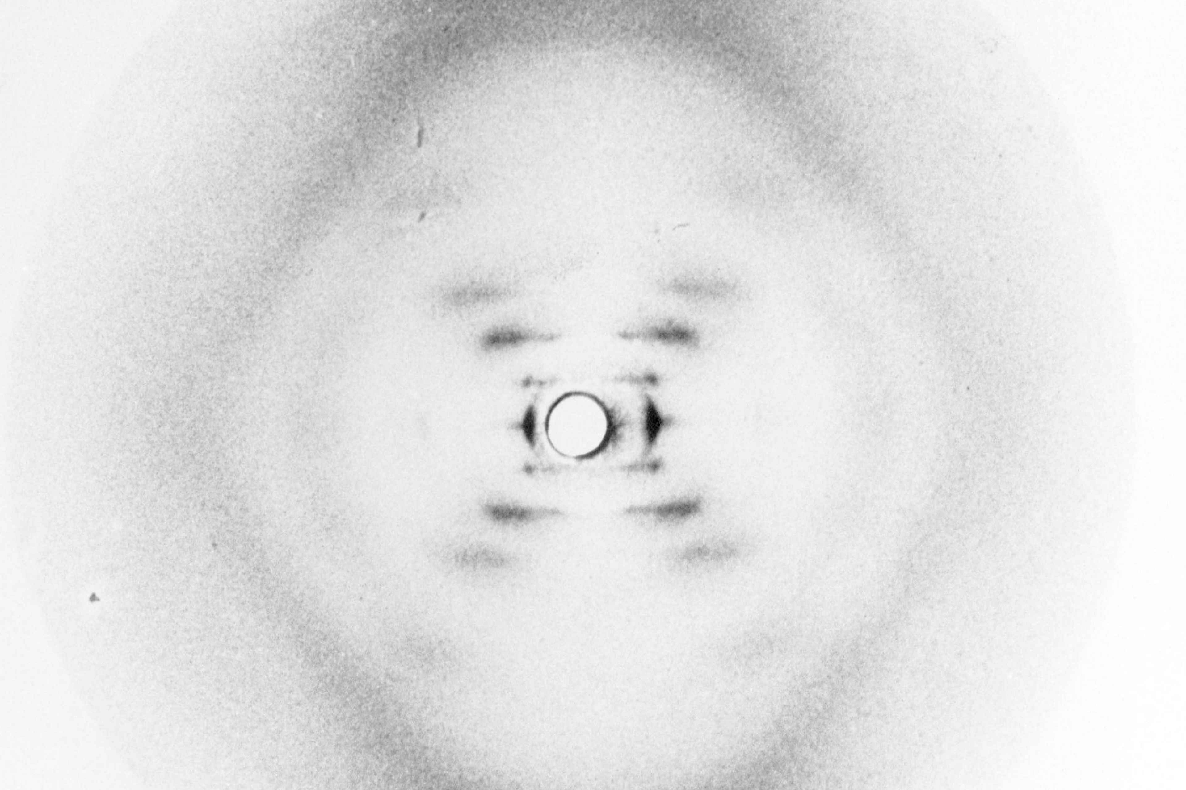 DNA discovery, X-ray diffraction, 1952