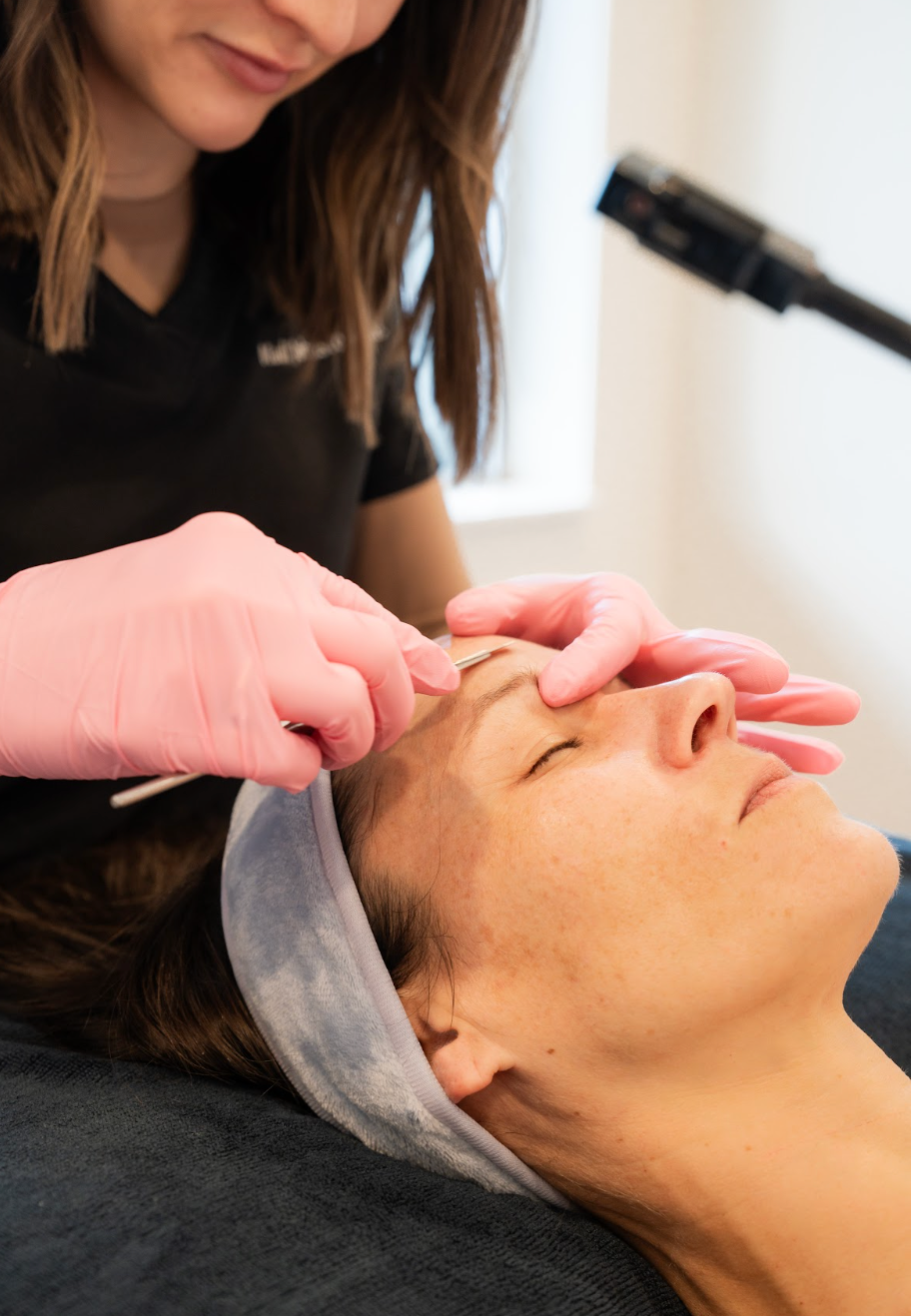 Dermaplaning in West Des Moines