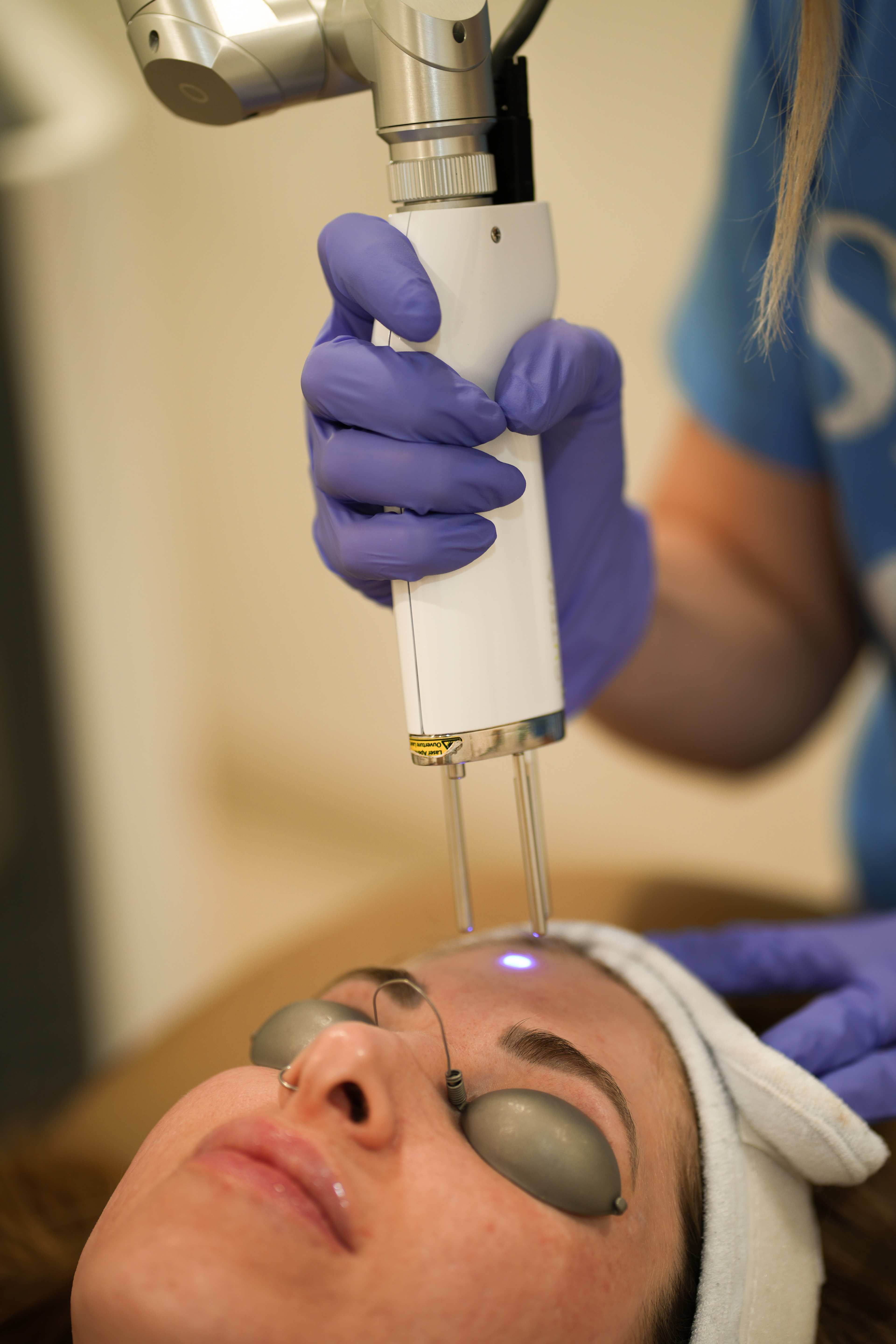 Laser Hair Removal in West Des Moines