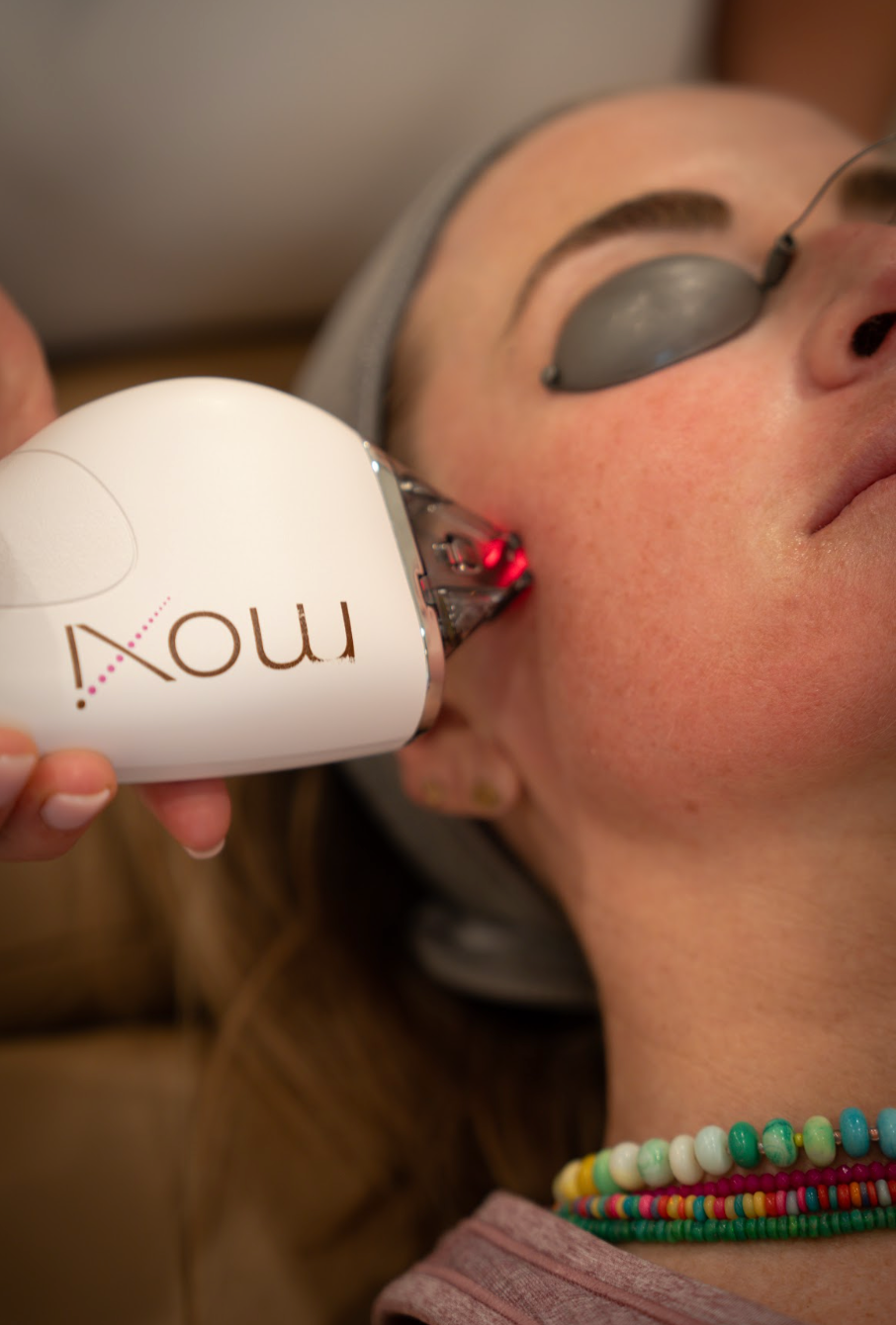 Moxi Laser in West Des Moines