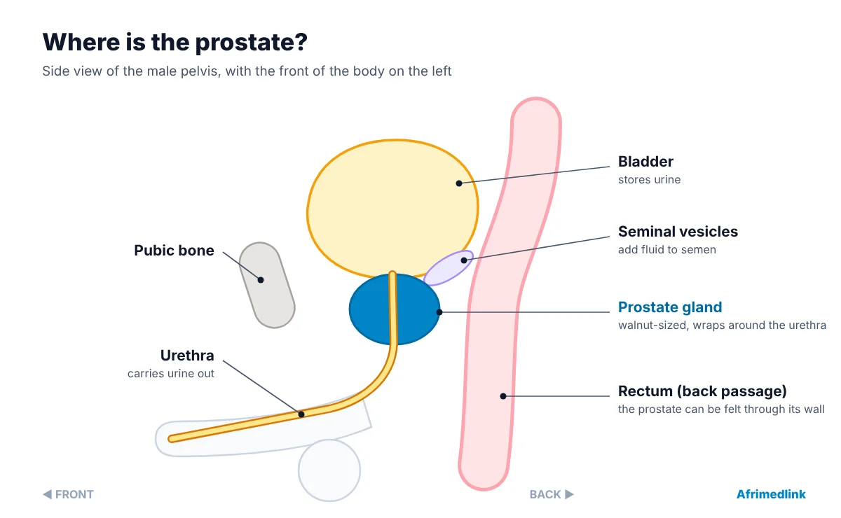 The prostate sits below the bladder and wraps around the urethra. Because it lies just in front of the rectum, a doctor can feel it during a rectal examination.
