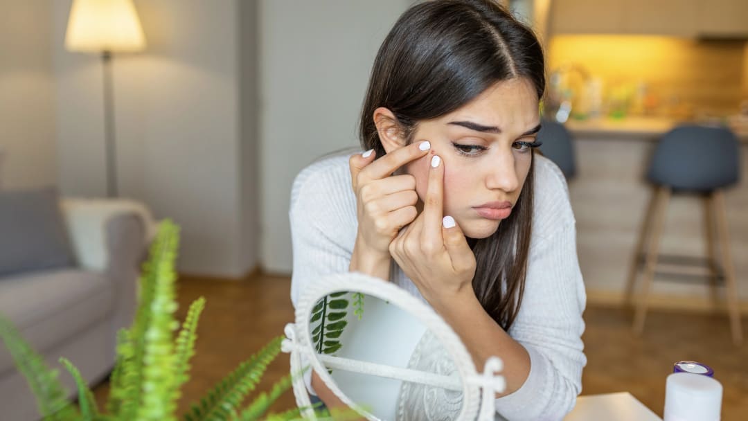 How to Get Rid of Acne with Essential Oils: 2 All-Natural Recipes