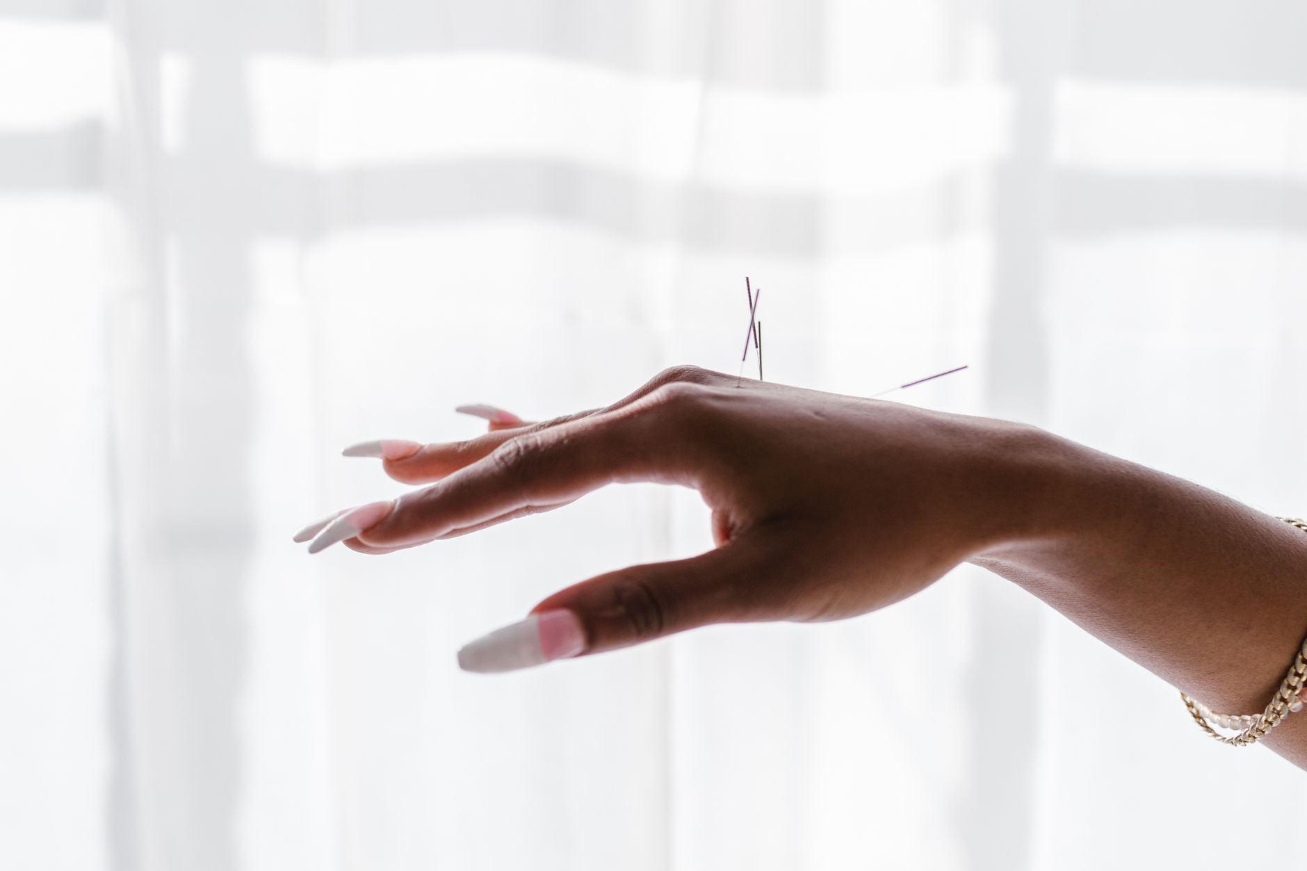 The Benefits of Acupuncture: How It Can Help Your Body