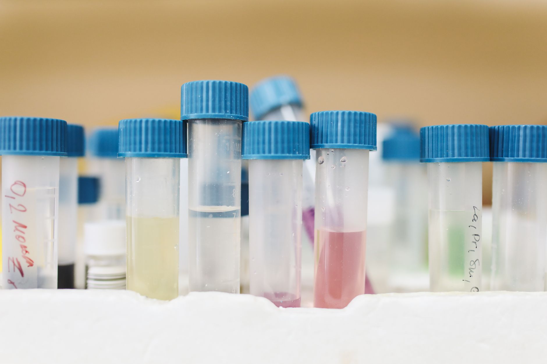 Different kinds of DNA tests