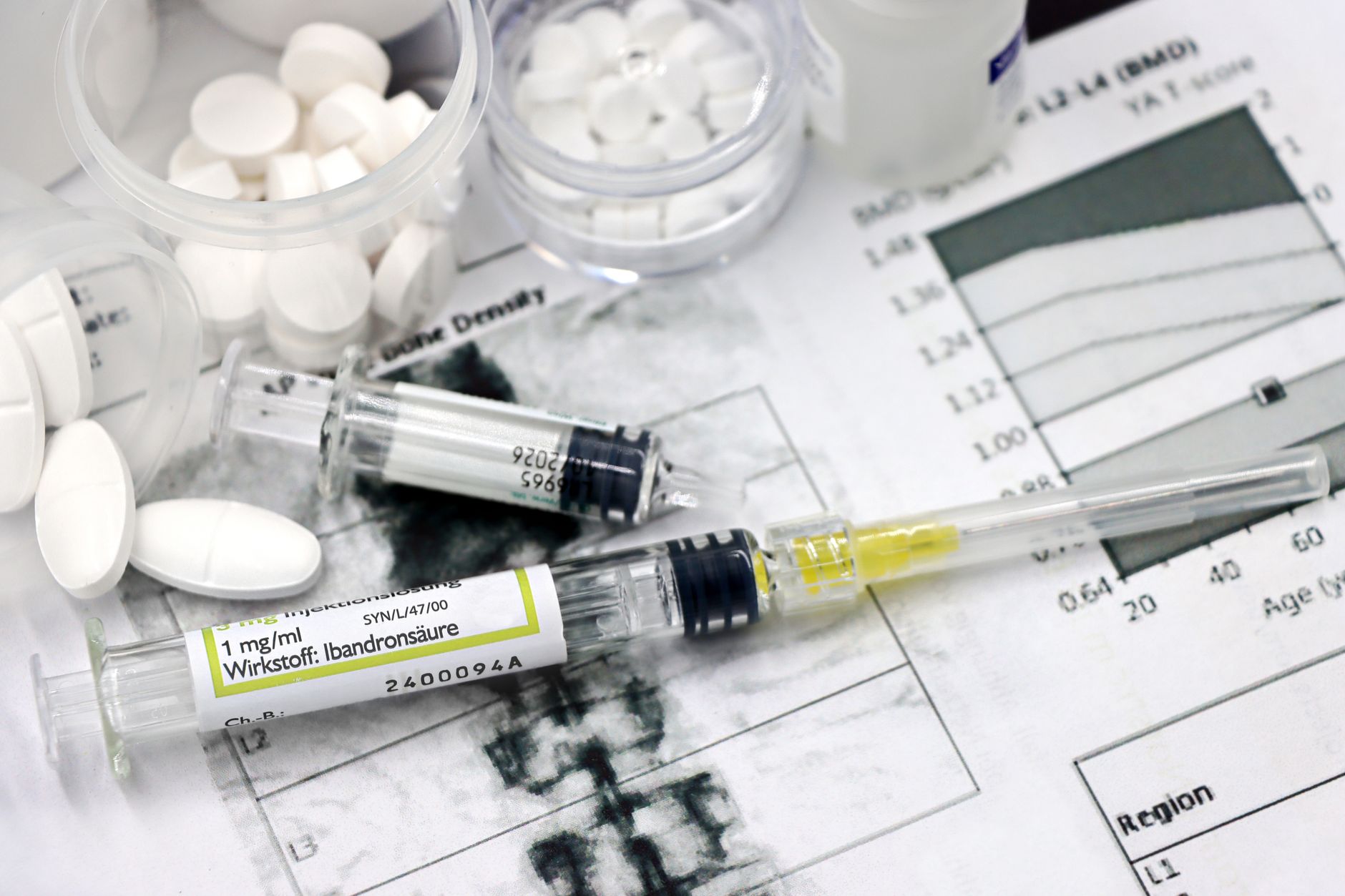 Exploring Therapy Options for Alzheimer’s Disease Patients