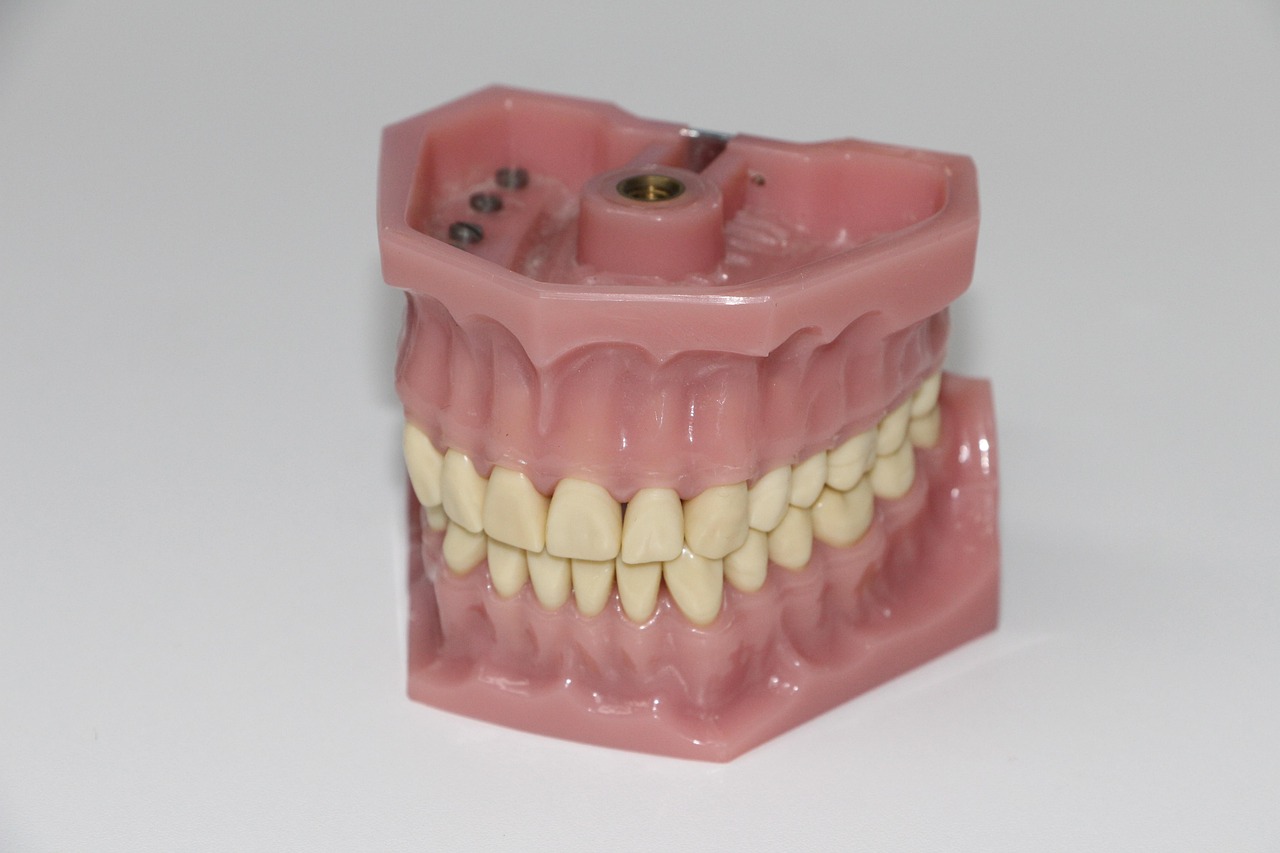 How dental implants can improve your lifestyle?